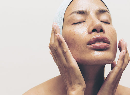 6 Problems of Every Girl with Oily Skin